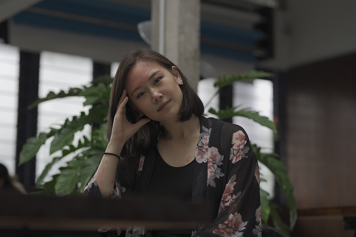 Rojak Daily/Afiqah Azizan Rocyie has embraced her condition